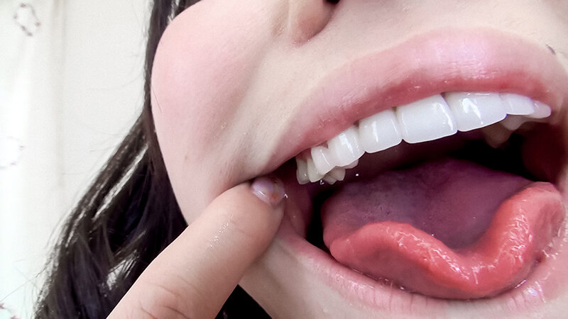 EVIS-541 第 3 部分 - 40 分钟