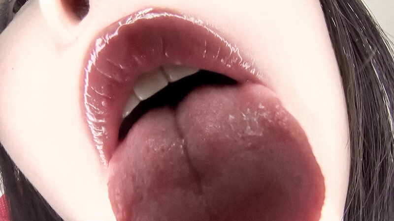 EVIS-546 Bagian 12 - 118 minit