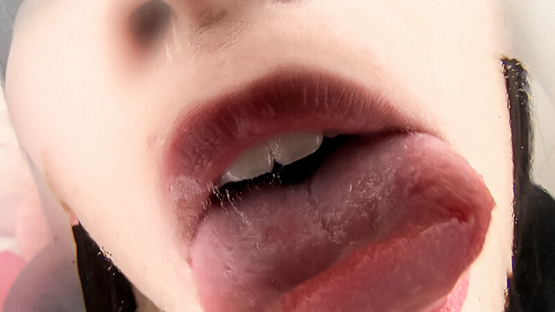 EVIS-546 Bagian 14 - 134 minit