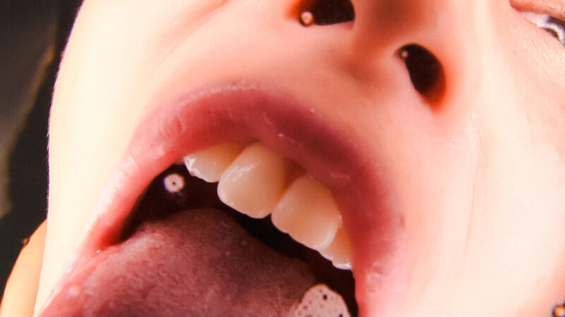 EVIS-550 Bagian 18 - 115 minit