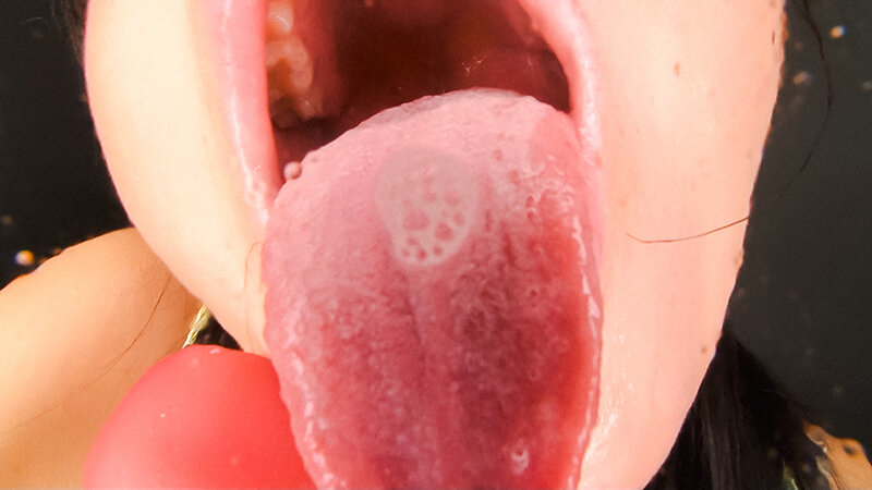 EVIS-550 Bagian 20 - 125 minit