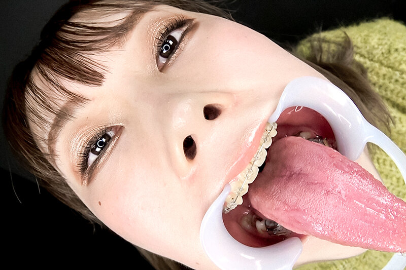 EVIS-573 Bagian 18 - 132 minit