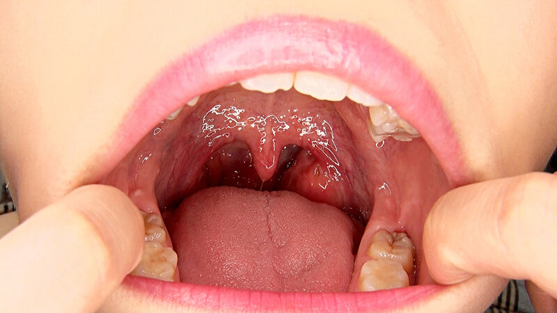 EVIS-604 第 8 部分 - 72 分钟