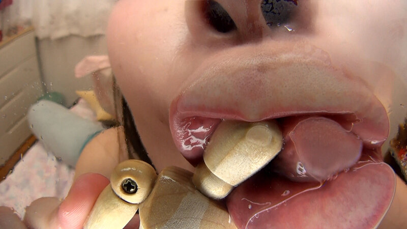 EVIS-607 Bagian 14 - 108 minit