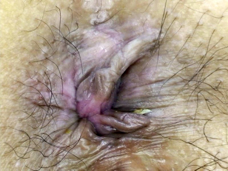 GAT-010 Part 11 - 150 minutes