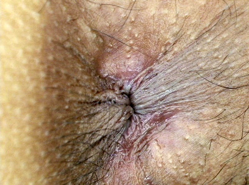 GAT-010 Part 18 - 234 minutes