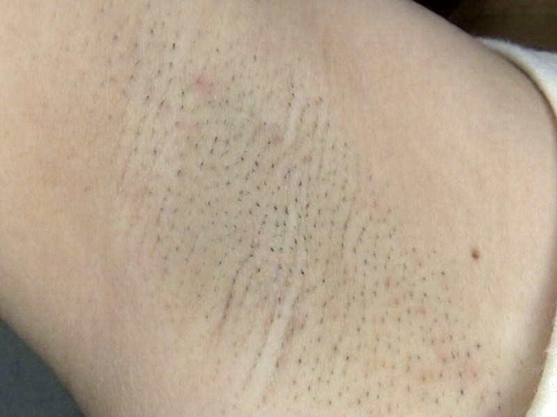 GAT-011 パート 10 - 138 分