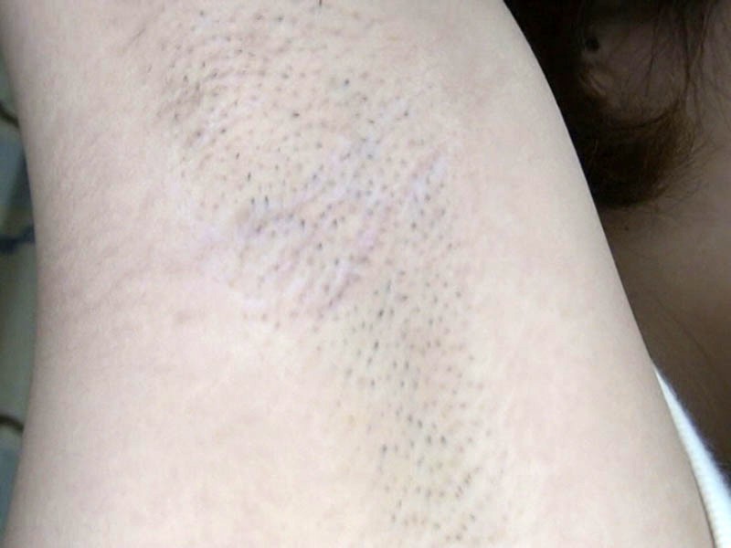 GAT-011 パート 11 - 150 分