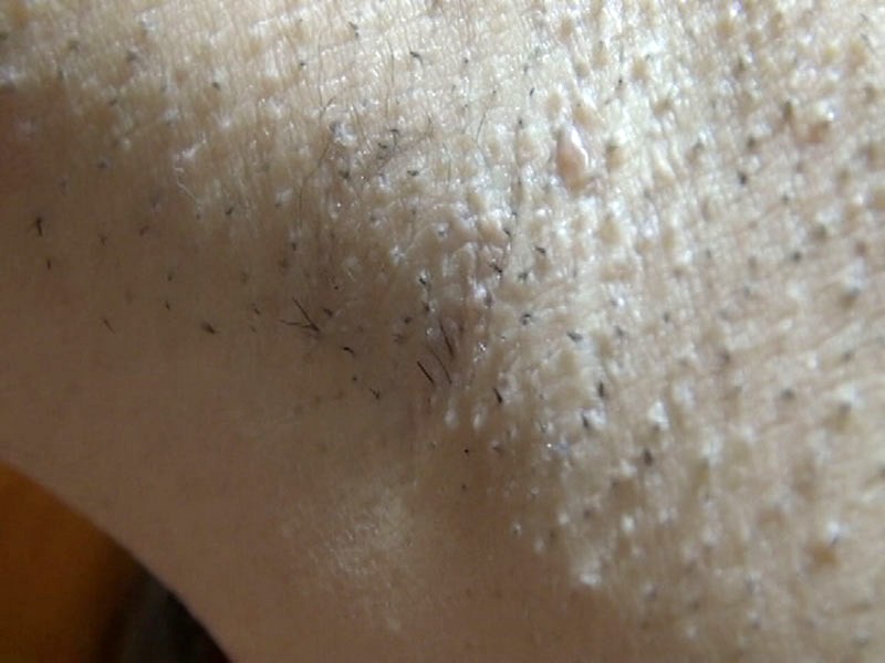 GAT-011 パート 13 - 174 分