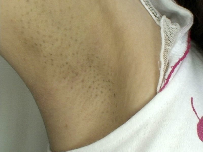 GAT-011 パート 15 - 198 分