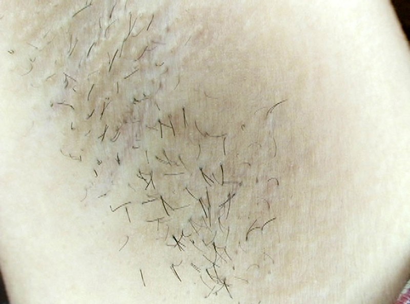 GAT-011 パート 17 - 222 分