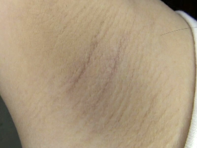 GAT-011 パート 18 - 234 分