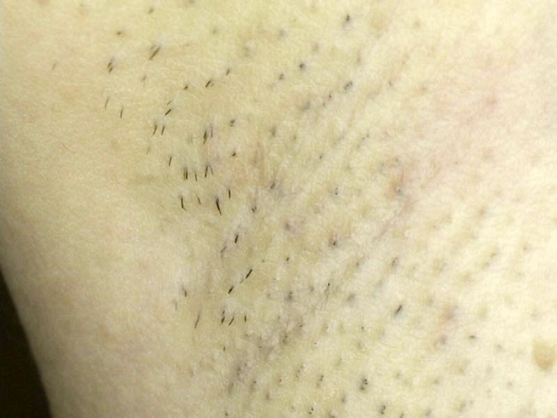 GAT-011 パート 19 - 246 分