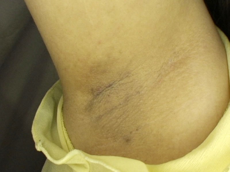 GAT-011 パート 20 - 258 分