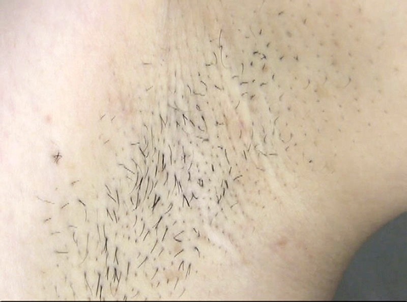 GAT-011 パート 5 - 78 分