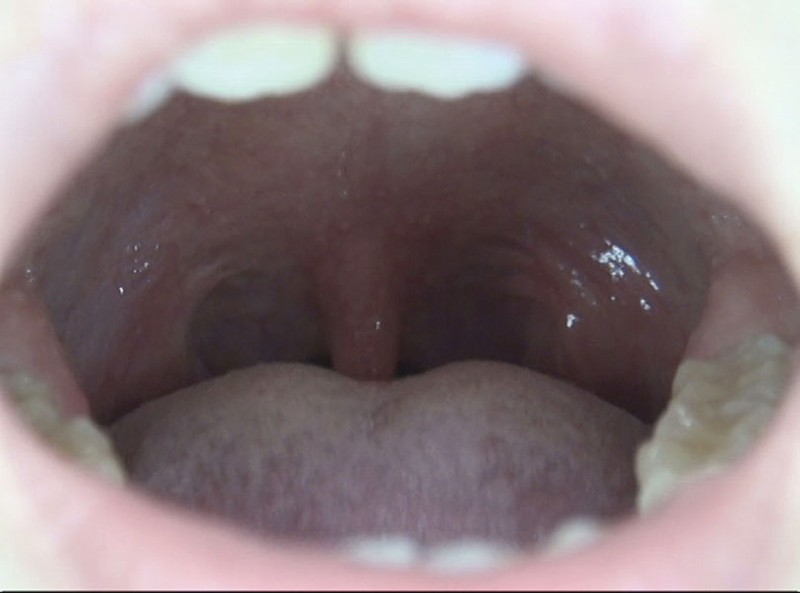 GAT-015 Bagian 1 - 30 minit