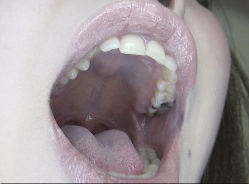 GAT-015 第 10 部分 - 246 分钟