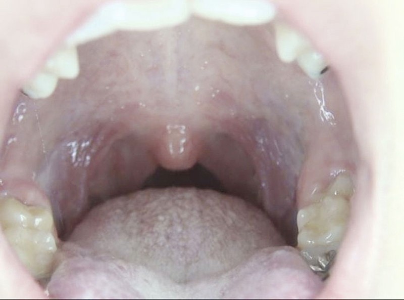 GAT-015 第 2 部分 - 54 分钟