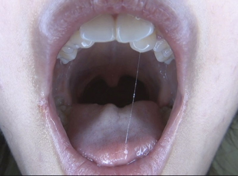 GAT-015 第 3 部分 - 78 分钟