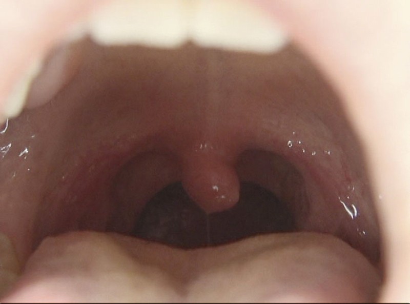 GAT-015 第 4 部分 - 102 分钟