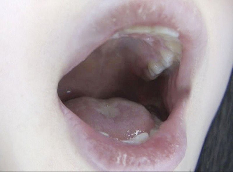 GAT-015 第 5 部分 - 126 分钟