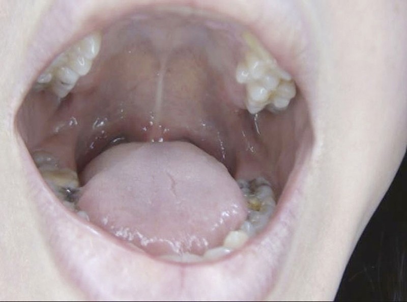 GAT-015 Part 6 - 150 minutes