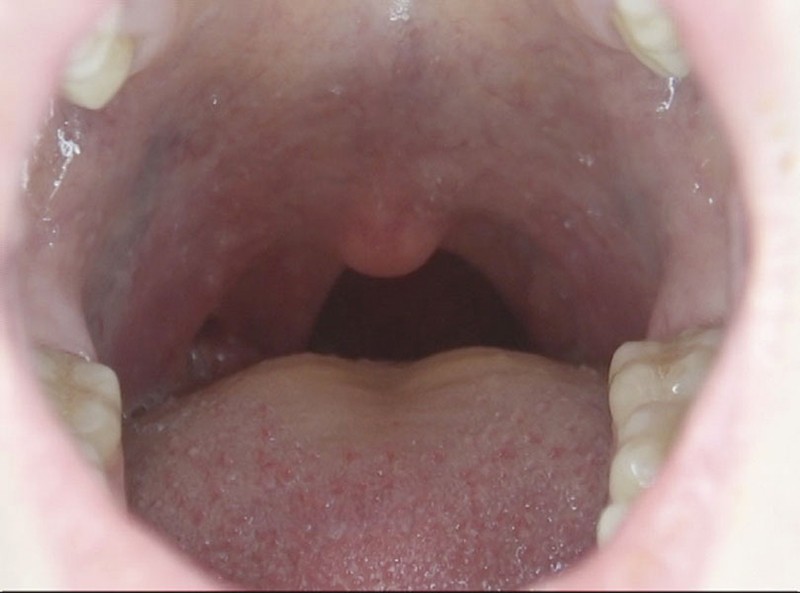 GAT-015 第 7 部分 - 174 分钟