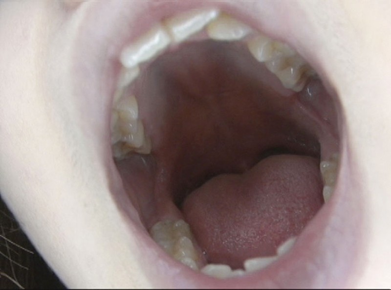 GAT-015 第 8 部分 - 198 分钟