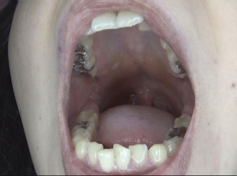 GAT-015 第 9 部分 - 222 分钟