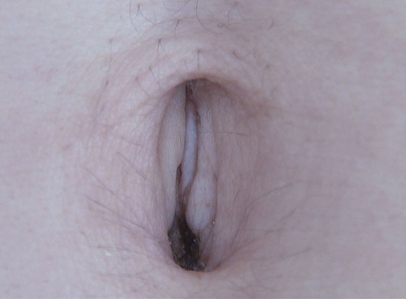 GAT-016 第 17 部分 - 222 分钟