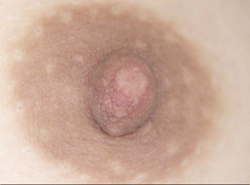 GAT-017 Bagian 7 - 102 minit