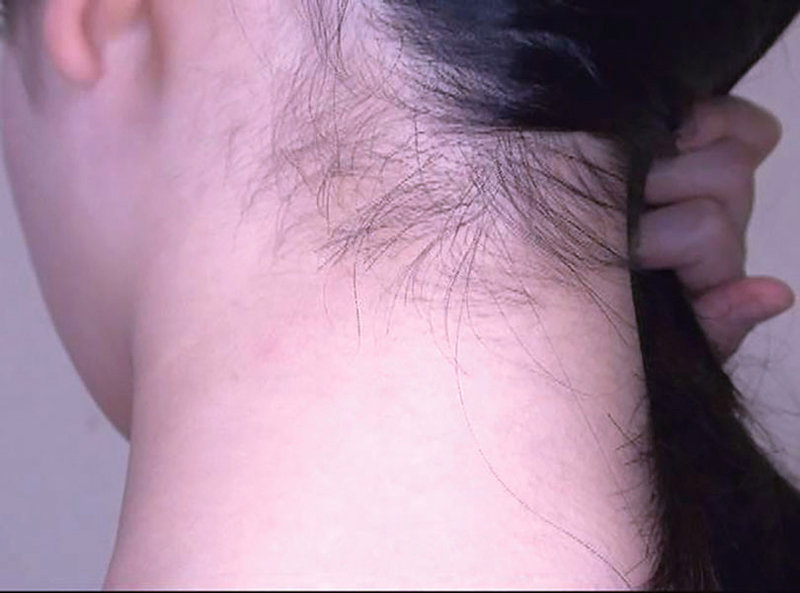 GAT-019 Bagian 17 - 222 minit