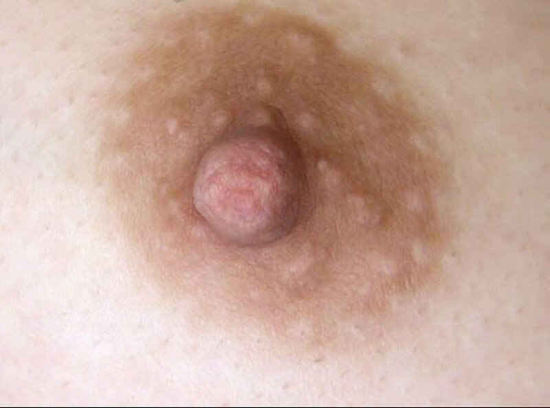 GAT-020 Part 14 - 186 minutes