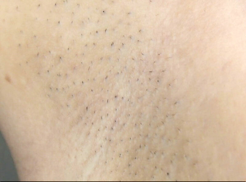 GAT-022 第 1 部分 - 30 分钟