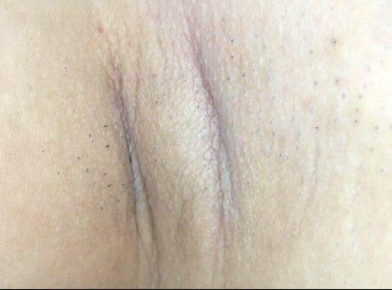 GAT-022 第 10 部分 - 138 分钟