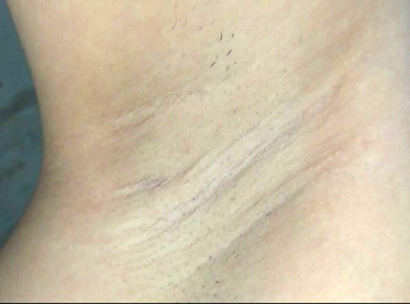 GAT-022 Part 11 - 150 minutes