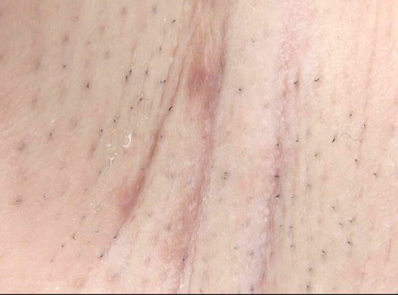 GAT-022 第 13 部分 - 174 分钟