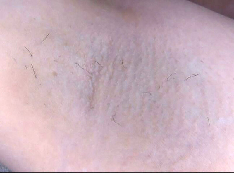 GAT-022 Part 15 - 198 minutes