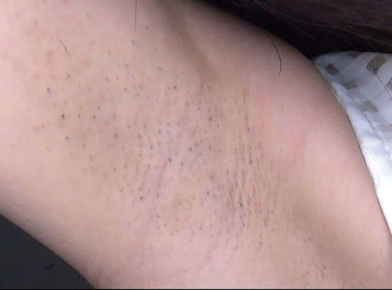 GAT-022 第 19 部分 - 246 分钟