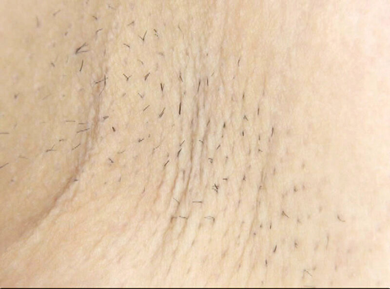 GAT-022 Part 3 - 54 minutes