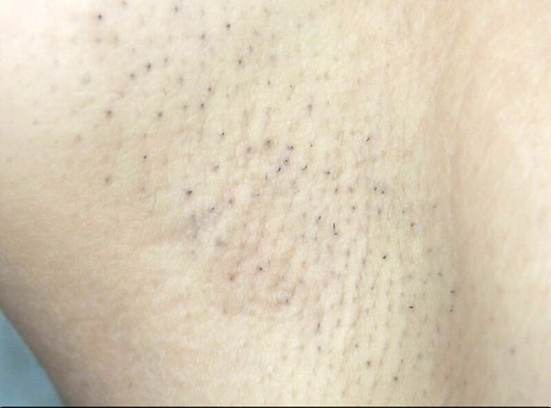 GAT-022 Part 5 - 78 minutes