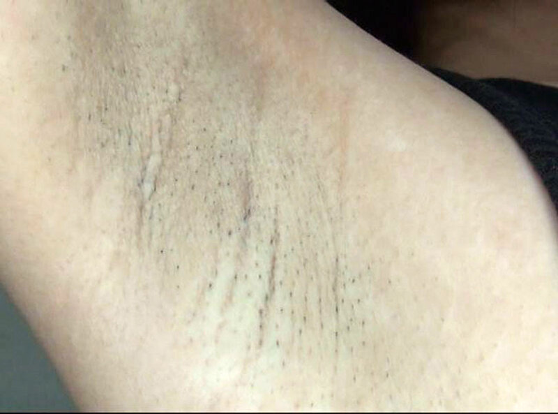 GAT-022 第 7 部分 - 102 分钟