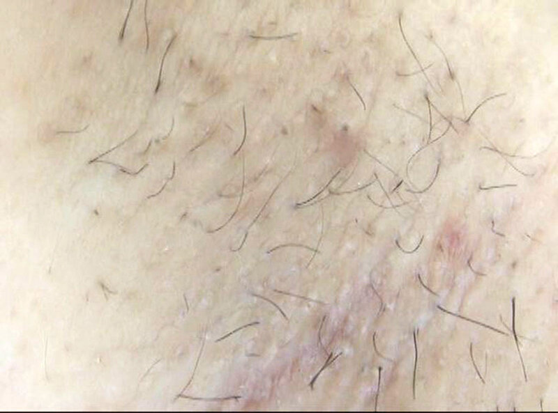 GAT-022 第 8 部分 - 114 分钟