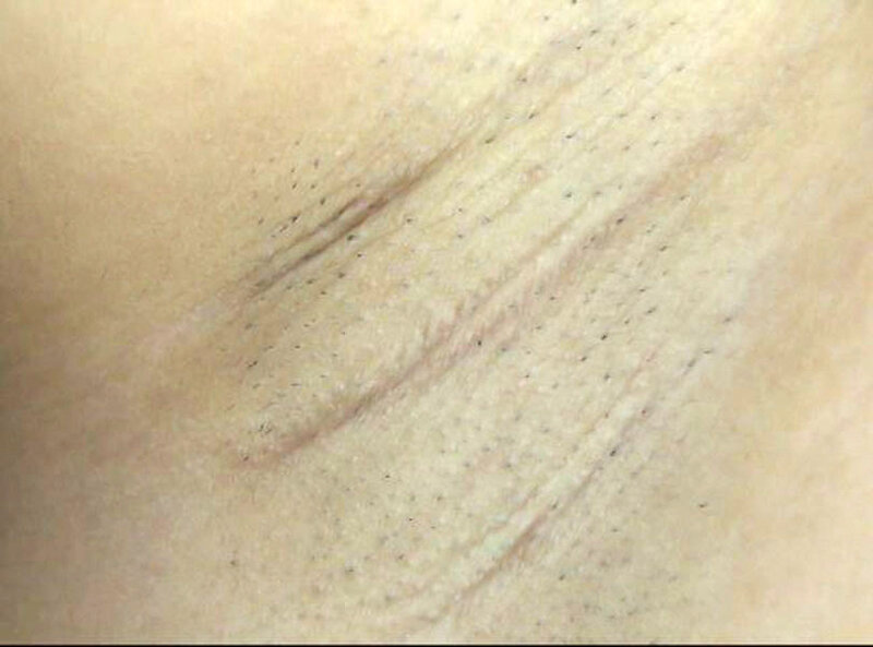 GAT-022 Part 9 - 126 minutes