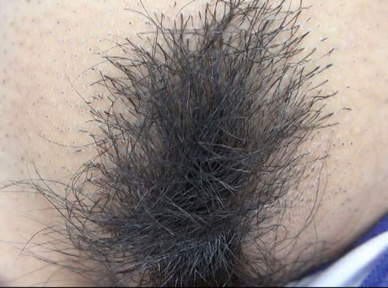 GAT-024 Bagian 1 - 30 minit