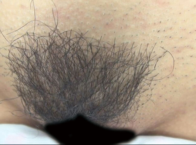 GAT-024 Bagian 14 - 186 minit