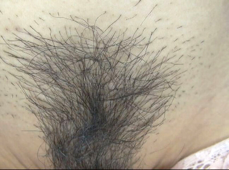 GAT-024 パート 17 - 222 分