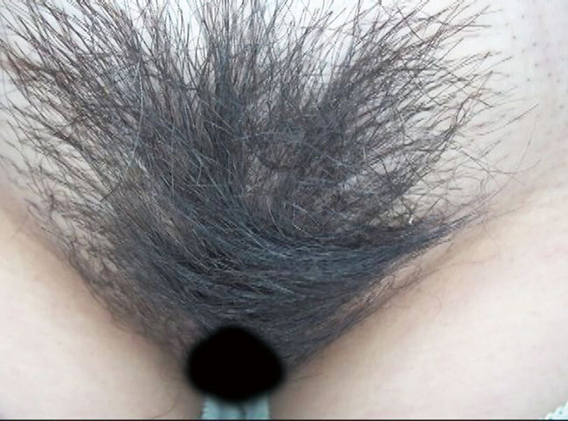 GAT-024 Bagian 18 - 234 minit