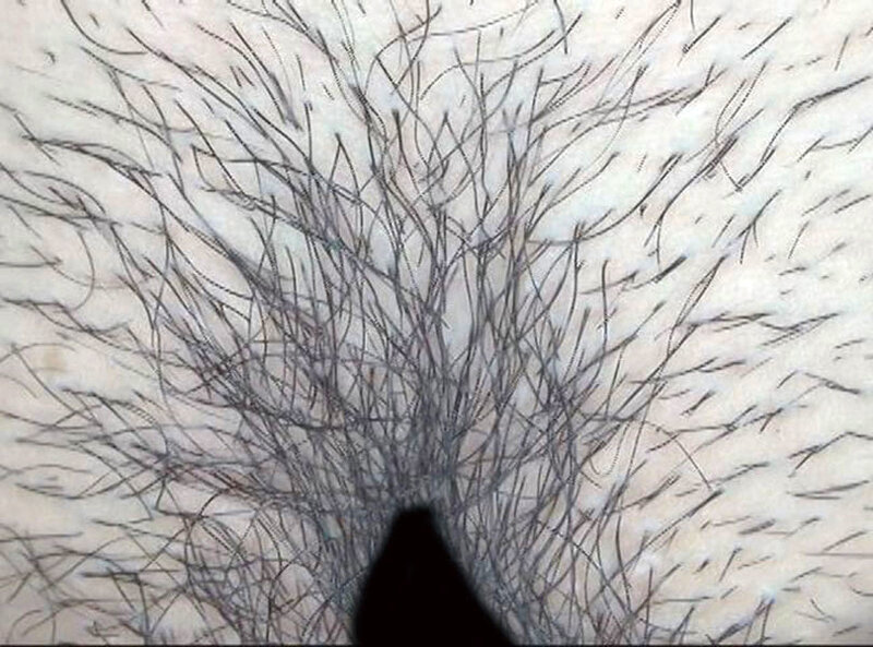 GAT-024 Bagian 4 - 66 minit