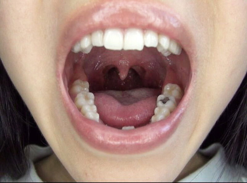 GAT-025 Bagian 1 - 30 minit